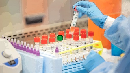 Ινστιτούτο Παστέρ: Τον Οκτώβριο τα πρώτα αποτελέσματα εμβολίου!